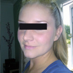 plan coquin sur Montbéliard